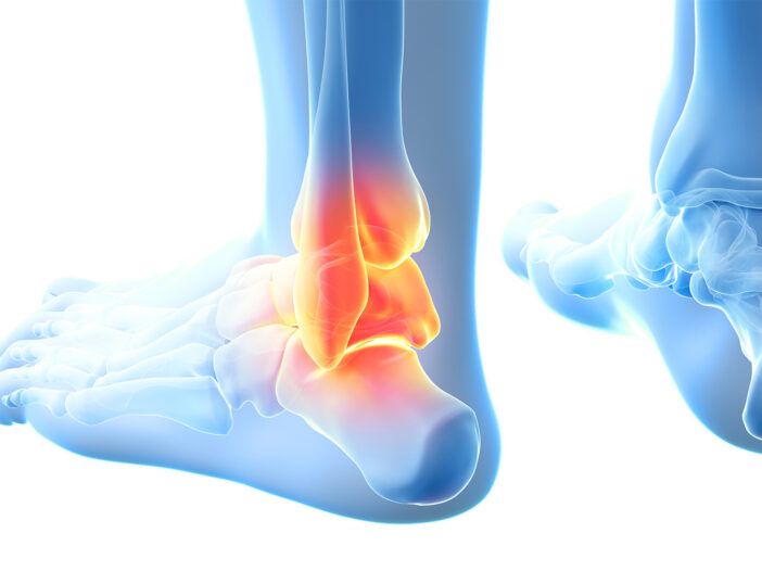 ケガの予防・治療に効果的！科学的筋トレメニュー
